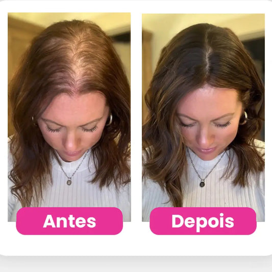 KIT SAÚDE FEMININA CABELO, PELE E UNHAS - LEVE 3 PAGUE 2